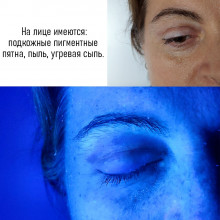 Лампа Вуда B-221 с лупой