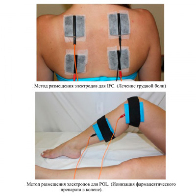 Аппарат для электротерапии и электростимуляции Ibramed Neurodyn (6 каналов) Аппарат для электротерапии и электростимуляции Ibramed Neurodyn (6 каналов)